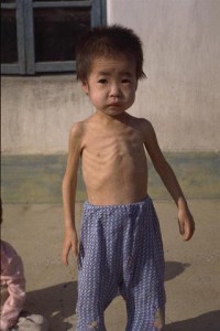 A severely malnourished boy toddler stands outside the Oop Nursery in the Centre of Pyongsan County in the town of Pyongsan in North Hwanghae province, near Pyongyang, the capital. In addition to malnutrition, causing a general listlessness, the children at this centre suffer from inadequate hygiene due to the lack of soap and other basic supplies. The Democratic People's Republic (DPR) of Korea continues to suffer acute food shortages in 1997, the result of a weakened economy and the 1995 floods which displaced 100,000 families and affected 5.2 million people. With the near depletion of Government stockpiles, UNICEF has issued a special appeal to donors for high energy milk (HEM) - a combination of milk powder, suger, oil and mineral salts - to rehabilitate acutely malnourished children. In addition, other supplementary feeding programmes and vaccinations are continuing, as well as the provision of multi-vitamin tablets for pregnant and lactating mothers, and seeds or seedlings for nursery gardens. UNICEF is also cooperating with international NGOs and the World Food Programme (WFP) to provide food for the 2.4 million children under six years of age.