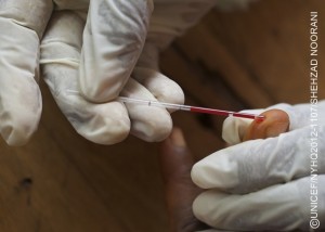 A youth counsellor collects a blood sample from an individual, for HIV testing, at a mobile voluntary counselling and testing site set up by the UNICEF-supported NGO Research and Integrated Development Centre (RICDC), in the city of Ganta in Nimba County. The Centre also has youth volunteers who provide voluntary counselling and testing for the general public and raise awareness about HIV/AIDS.  In April/May 2012 in Liberia, the Government continues to rebuild infrastructure and basic social services destroyed during 14 years of civil war that ended in 2003. Long-term national policies and strategies are improving the health and nutrition status of Liberian children and women. However, despite substantial progress, economic, social and development challenges remain. The country remains one of the worlds poorest, with 64 per cent of the population living below the poverty line. Many Liberians still lack access to basic services, and rising food prices are among factors that affect household food and nutrition security. Malnutrition is a primary cause of under-5 mortality in the country, and chronic malnutrition remains high. An estimated 42 per cent of children under age five are stunted. The situation is exacerbated by the influx of an estimated 178,000 refugees from neighbouring Côte d'Ivoire, who fled violence in their home country following the 2010 presidential election there. Although many have returned home, approximately 135,000 remaining refugees continue to strain already limited resources. Working with the Government, NGOs and other partners, UNICEF supports a range of child nutrition programmes, as well as other health, water, sanitation and hygiene (WASH), education and protection interventions.