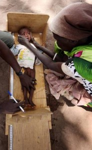 Aqual comforts her six-month-old grandson, whose height is being measured, at a UNICEF-supported malnutrition clinic in the town of Kuajok, capital of Warrap State in Southern Sudan. The boy and his twin sibling are among more than 300 malnourished children currently being treated at the clinic. The children and their grandmother, their sole caretaker, have come to Kuajok from Khartoum, the countrys capital. They are among some 14,700 people who were displaced during the civil war and have returned to the area following the January referendum. The twins, who each weighed only 4.7 kilogrammes when they first arrived in Kuajok, now each weigh 5.3 kilogrammes. From 9 to 16 March 2011, UNICEF Goodwill Ambassador Mia Farrow and UNICEF Goodwill Ambassador (United Kingdom) Martin Bell visited Southern Sudan to raise awareness on issues affecting children and their families at this historic juncture. The visit comes two months after the landmark January 2011 referendum in Southern Sudan, which overwhelmingly endorsed the creation of an independent country for the region. The new nation is slated for creation on 9 July this year. The referendum was part of the 2005 Comprehensive Peace Agreement ending the civil war, which killed two million people, displaced four million, and decimated social services. The situation of children and women in the region remains critical: One of every seven children dies before age five, and one in six Southern Sudanese women dies from pregnancy-related causes. Only an estimated 10 per cent of children are fully vaccinated, and fewer than half of all children have completed five years of primary education. Millions of people continue to be affected by insecurity, including in Western Equatoria State, which borders the Democratic Republic of the Congo. From there, rebels from the Ugandan Lords Resistance Army (LRA) are continuing to attack, abduct and rape villagers on both sides of the border. Additionally, the Abyei area, which straddles disputed territory between northern and southern parts of Sudan, is also experiencing fighting. Ms. Farrow and Mr. Bell visited the Abyei area, where they met with children and women displaced by recent clashes. In Western Equatoria, they visited a transit centre for children rescued from the LRA, primary and maternal health care facilities and a support site for people affected by HIV/AIDS. In Warrap State, they also met with families who had been displaced during the civil war and were returning home. In Juba, capital of Southern Sudan, they met with government officials and representatives from UN, NGO and other partners.