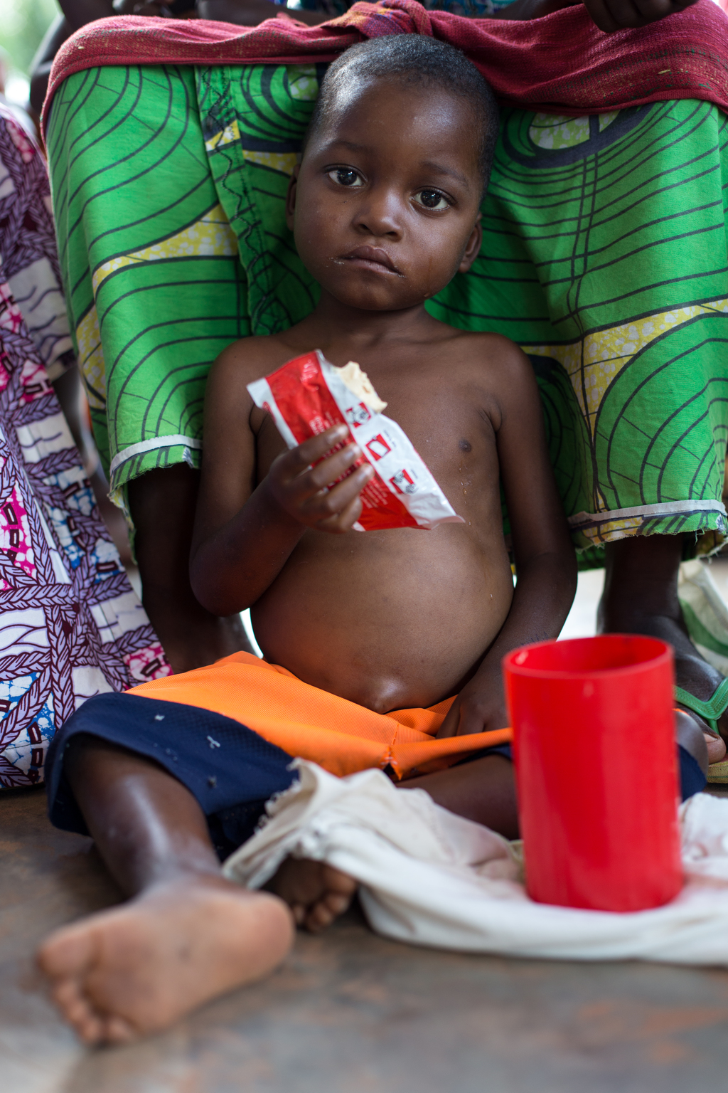 A child suffering from malnutrition is feeding himself with Plumpy Nut - ready-to-use therapeutic food - offered by UNICEF to the health center of Tshinyama, a village near Miabi, located 30 km north-west of Mbuji-mayi, in the direction of Kananga, in the province of Kasai Orientale, in the south Of the Democratic Republic of the Congo, a region plagued by conflict between the militia of the traditional leader Kamuina Nsapu and the Armed Forces of the Democratic Republic of the Congo (FARDC) since June 2016. - Un enfant souffrant de malnutrition se nourrit de « Plumpy Nut », de la nourriture thérapeutique prête à l'emploi, offerte par l'UNICEF au centre de santé de Tshinyama, un petit village proche de Miabi, situé à 30 km au nord-ouest de Mbuji-mayi, en direction de Kananga, dans la province du Kasaï Orientale, au sud de la République démocratique du Congo, une région en proie aux conflits entre les miliciens du chef traditionnel Kamuina Nsapu et les Forces Armées de la République Démocratique du Congo (FARDC) depuis juin 2016. In August 2016, fighting oke out in one of the Democratic Republic of Congos (DRC) poorest regions - Kasai - after a traditional leader was killed in clashes with security forces. The situation deteriorated in 2017, unleashing a wave of violence that has now engulfed nine of the countrys 26 provinces.