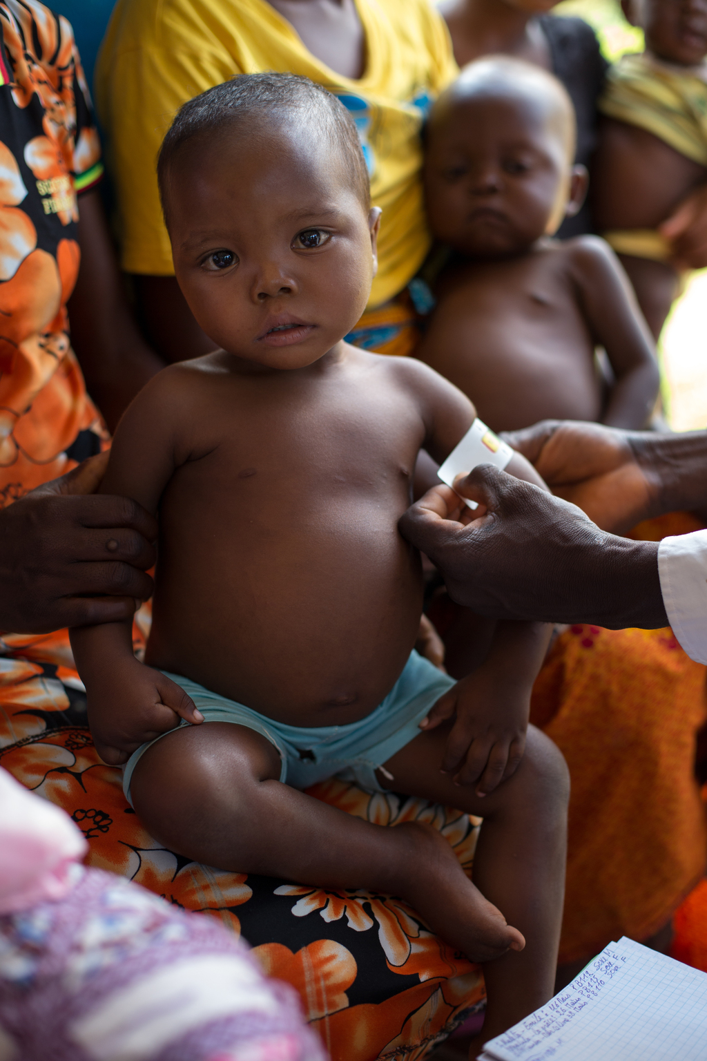 A nurse is screening for cases of malnutrition in the health center of Tshinyama, a village near Miabi, located 30 km north-west of Mbuji-mayi, in the direction of Kananga, in the province of Kasai Orientale, in the south Of the Democratic Republic of the Congo, a region plagued by conflict between the militia of the traditional leader Kamuina Nsapu and the Armed Forces of the Democratic Republic of the Congo (FARDC) since June 2016. - Un infirmier effectue le dépistage de cas de malnutrition dans le centre de santé de Tshinyama, un petit village proche de Miabi, situé à 30 km au nord-ouest de Mbuji-Mayi, en direction de Kananga, dans la province du Kasaï Orientale, au sud de la République Démocratique du Congo, une région en proie aux conflits entre les miliciens du chef traditionnel Kamuina Nsapu et les Forces Armées de la République démocratique du Congo (FARDC) depuis juin 2016. In August 2016, fighting oke out in one of the Democratic Republic of Congos (DRC) poorest regions - Kasai - after a traditional leader was killed in clashes with security forces. The situation deteriorated in 2017, unleashing a wave of violence that has now engulfed nine of the countrys 26 provinces.